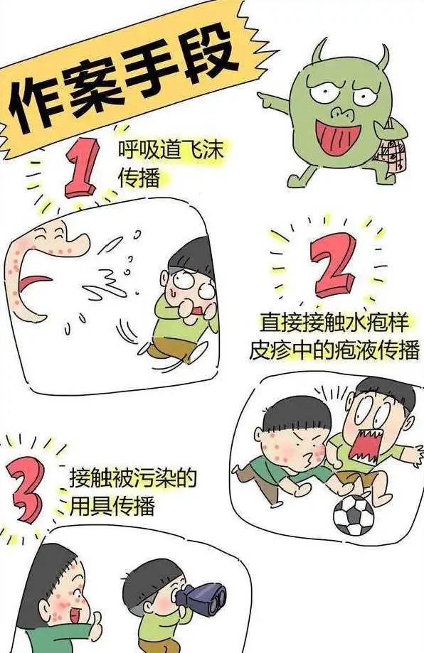 【水痘聚集性疫情定义/水痘聚集性疫情是指】