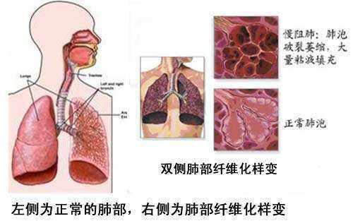【抗击新冠肺炎疫情/抗击新冠肺炎疫情先进民营企业】