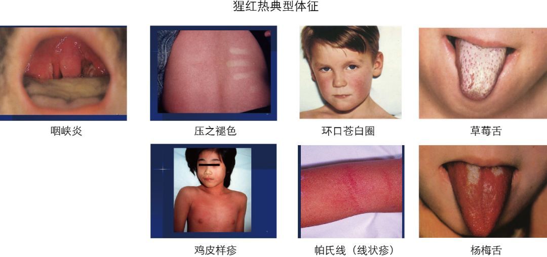 疫情来信:疫情的信