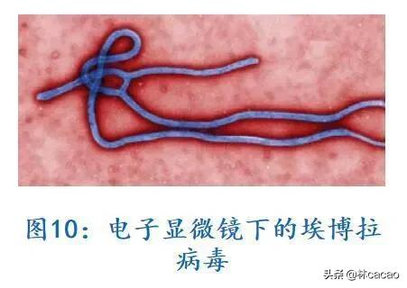 人感染猪瘟疫情/人得猪瘟疫是什么症状